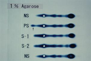 1% Agarose