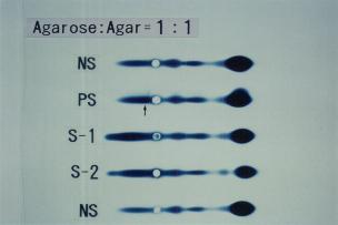 Agarose:Agar=1:1