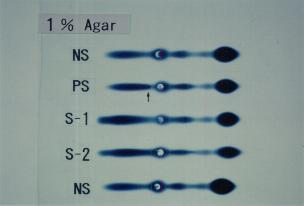 1% Agar