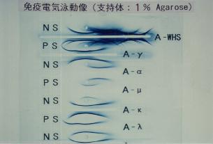 �Ɖu�d�C�j����(1% Agarose)