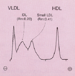 ���|�t�H�[�f���V�g�O����