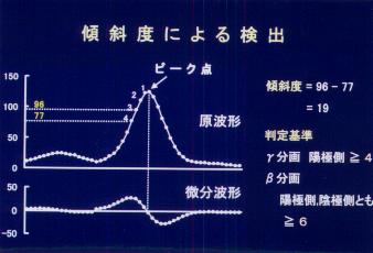 �X�Γx�ɂ�錟�o