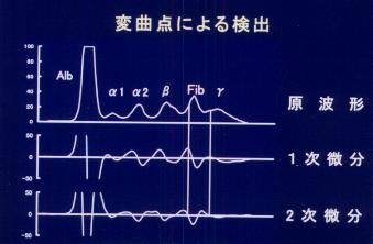 �ϋȓ_�ɂ�錟�o